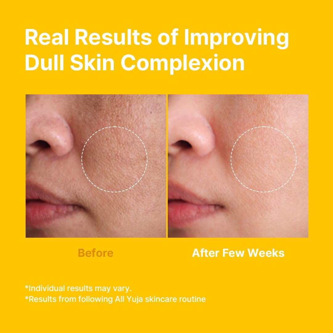 Farmstay Citrus Yuja Vitalizing Toner – Vitamin C Facial Toner for Dry & Sensitive Skin, Dark Spot Correcting, Moisturizing & pH-Balancing, Smoothing, Korean Skin Care, for Women & Men, 9.46 fl. oz.