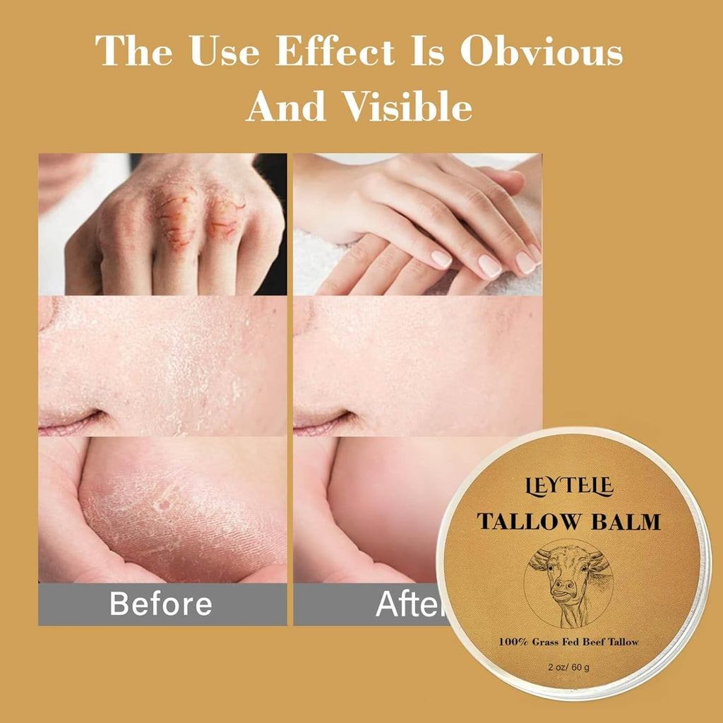 Beef Tallow and Honey Balm, 100% Grass-Fed Beef Tallow Skincare for Nourishing and Moisturizing Skin, Body and Face Moisturizer, 60g